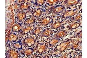 Immunohistochemistry (IHC) image for anti-Protein Phosphatase 1, Regulatory (Inhibitor) Subunit 9A (PPP1R9A) (AA 1-243) antibody (ABIN7161885)