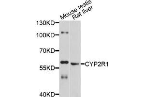 Western blot analysis of extracts of various cell lines, using CYP2R1 antibody (ABIN4903430) at 1:1000 dilution.