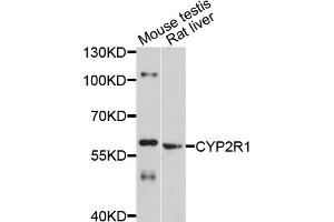 Western blot analysis of extracts of various cell lines, using CYP2R1 antibody (ABIN4903430) at 1:1000 dilution. (CYP2R1 Antikörper)