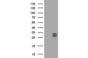 Image no. 4 for anti-O6-Methylguanine-DNA-Methyltransferase (MGMT) antibody (ABIN1499456) (MGMT Antikörper)