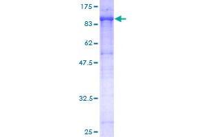 Image no. 1 for Endoglin (ENG) (AA 27-658) protein (GST tag) (ABIN1352796)