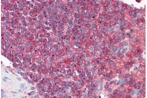 Human Spleen: Formalin-Fixed, Paraffin-Embedded (FFPE) (ICAM-3/CD50 Antikörper)