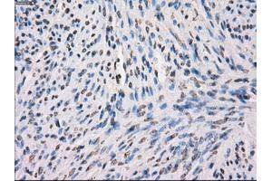 Immunohistochemical staining of paraffin-embedded Ovary tissue using anti-MAP2K1 mouse monoclonal antibody. (MEK1 Antikörper)
