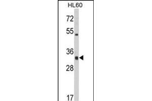 Western blot analysis of HLA-DRA Antibody (C-term) (ABIN390771 and ABIN2841029) in HL60 cell line lysates (35 μg/lane). (HLA-DRA Antikörper  (C-Term))