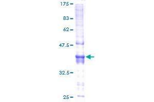 Image no. 1 for Chromosome 20 Open Reading Frame 7 (C20orf7) (AA 1-158) protein (GST tag) (ABIN1347433)