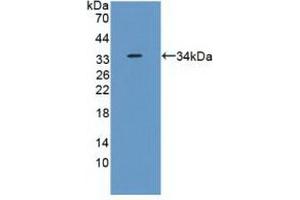 Detection of Recombinant RPS6Ka1, Human using Polyclonal Antibody to Ribosomal Protein S6 Kinase Alpha 1 (RPS6Ka1) (RPS6KA1 Antikörper  (AA 62-321))