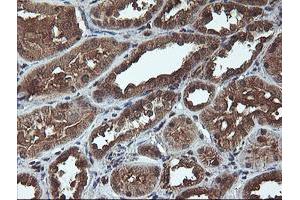 Immunohistochemical staining of paraffin-embedded Human Kidney tissue using anti-C1S mouse monoclonal antibody. (C1S Antikörper)