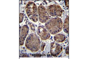 Immunohistochemistry (Paraffin-embedded Sections) (IHC (p)) image for anti-C-Type Lectin Domain Family 7, Member A (CLEC7A) (AA 70-98), (N-Term) antibody (ABIN657292)
