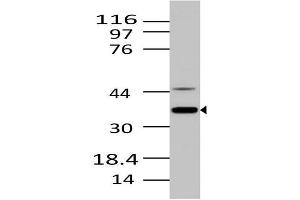 Image no. 1 for anti-MKI67 FHA Domain-Interacting Nucleolar Phosphoprotein (MKI67IP) (AA 90-210) antibody (ABIN5027394) (NIFK Antikörper  (AA 90-210))