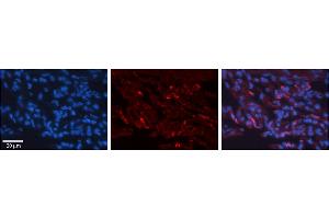 Rabbit Anti-H6PD Antibody     Formalin Fixed Paraffin Embedded Tissue: Human Lung Tissue  Observed Staining: Cytoplasmic in alveolar type I cells  Primary Antibody Concentration: 1:100  Other Working Concentrations: 1/600  Secondary Antibody: Donkey anti-Rabbit-Cy3  Secondary Antibody Concentration: 1:200  Magnification: 20X  Exposure Time: 0. (Glucose-6-Phosphate Dehydrogenase Antikörper  (N-Term))