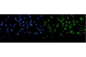 IF analysis of METTL3 using anti-METTL3 antibody (ABIN7602808).