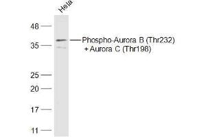 Hela lysates probed with Phospho-Aurora B (Thr232) + Aurora C (Thr198) Polyclonal Antibody, Unconjugated  at 1:500 dilution and 4˚C overnight incubation. (AurB/C Antikörper  (pThr198))