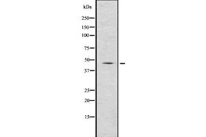 Western blot analysis of Renin using COLO205 whole  lysates. (Renin Antikörper  (Internal Region))