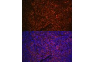 Immunofluorescence (IF) image for anti-Purinergic Receptor P2X, Ligand-Gated Ion Channel, 5 (P2RX5) (AA 341-422) antibody (ABIN6145117)