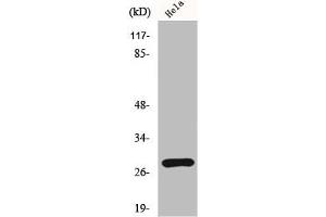 Western Blot analysis of HeLa cells using HES-6 Polyclonal Antibody (HES6 Antikörper  (N-Term))