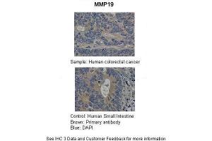 Immunohistochemistry (IHC) image for anti-Matrix Metallopeptidase 19 (MMP19) (C-Term) antibody (ABIN2779560)
