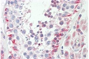Immunohistochemistry (IHC) image for anti-Ubiquinol-Cytochrome C Reductase Core Protein II (UQCRC2) (AA 235-264) antibody (ABIN1928409)