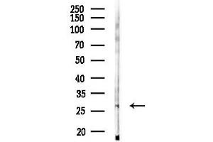 anti-Exosome Component 6 (EXOSC6) antibody