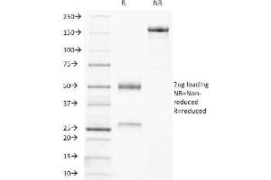 SDS-PAGE Analysis Purified CD21-Monospecific Mouse Monoclonal Antibody (CR2/3247). (CD21 Antikörper  (AA 142-240))