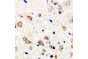 Immunohistochemical analysis of 42431 staining in human brain formalin fixed paraffin embedded tissue section.