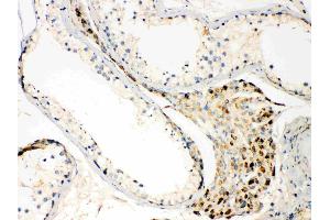 TECTA was detected in paraffin-embedded sections of human testis tissues using rabbit anti- TECTA Antigen Affinity purified polyclonal antibody (Catalog # ) at 1 µg/mL.