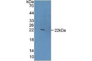 Western blot analysis of recombinant Human CLEC10A. (CLEC10A Antikörper  (AA 71-239))