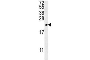 TREM2 antibody western blot analysis in MDA-MB435 lysate. (TREM2 Antikörper  (AA 22-50))