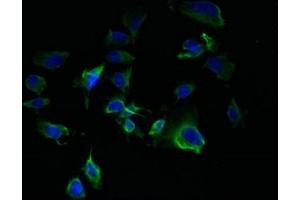 Immunofluorescent analysis of U251 cells using ABIN7172942 at dilution of 1:100 and Alexa Fluor 488-congugated AffiniPure Goat Anti-Rabbit IgG(H+L) (TM7SF3 Antikörper  (AA 22-295))