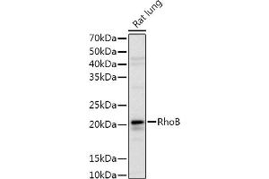 Western blot analysis of extracts of Rat lung, using RhoB Rabbit pAb antibody (ABIN3016775, ABIN3016776, ABIN3016777 and ABIN6219838) at 1:1000 dilution.