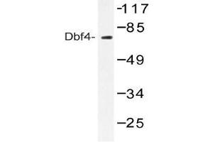 Western blot (WB) analysis of Dbf4 antibody in extracts from NIH-3T3 treated with H2O2 100uM 30'.