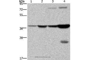 Western blot analysis of Mouse stomach and human fetal liver tissue, MCF-7 cell and mouse liver tissue, using FBP1 Polyclonal Antibody at dilution of 1:550 (FBP1 Antikörper)