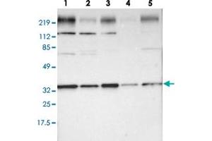 Western blot analysis of lane 1: RT-4, lane 2: U-251 MG, lane 3: A-431, lane 4: Liver and lane 5: Tonsil using STX4 polyclonal antibody . (Syntaxin 4 Antikörper)