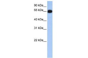 WB Suggested Anti-ALAS1 Antibody Titration: 0. (ALAS1 Antikörper  (N-Term))