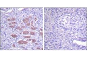 Immunohistochemistry analysis of paraffin-embedded human ovary tissue, using p40 phox (Ab-154) Antibody.