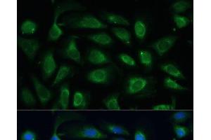 Immunofluorescence analysis of U-2 OS cells using SPARC Polyclonal Antibody at dilution of 1:100 (40x lens). (SPARC Antikörper)