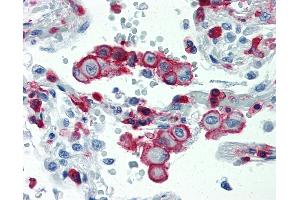 Anti-ITGB2 / CD18 antibody IHC staining of human lung. (Integrin beta 2 Antikörper  (AA 534-546))