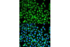 Immunofluorescence (IF) image for anti-Cell Division Cycle 34 (CDC34) antibody (ABIN1876645)