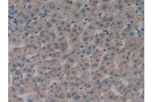Detection of DDR1 in Human Liver Tissue using Polyclonal Antibody to Discoidin Domain Receptor Family, Member 1 (DDR1) (DDR1 Antikörper  (AA 568-829))