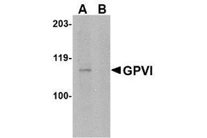 Image no. 1 for anti-Glycoprotein VI (Platelet) (GP6) (Internal Region) antibody (ABIN342706) (GP6 Antikörper  (Internal Region))