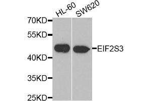 Western blot analysis of extracts of HL60 and SW620 cell lines, using EIF2S3 antibody.