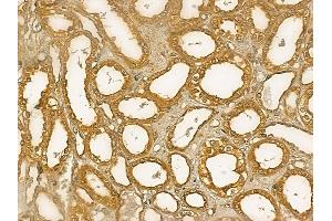 GMPPB Mouse Monoclonal Antibody at 1/100 staining human normal kidney tissue by IHC-P. (GMPPB Antikörper)