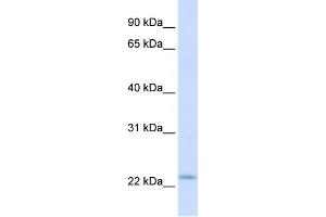WB Suggested Anti-REEP1 Antibody Titration:  0.