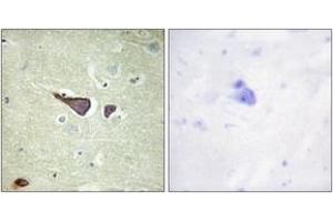 Immunohistochemistry analysis of paraffin-embedded human brain tissue, using IGF2R (Ab-2409) Antibody. (IGF2R Antikörper  (AA 2381-2430))