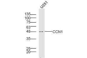 U251 lysates probed with Cry61 Polyclonal Antibody, Unconjugated  at 1:300 overnight at 4˚C. (CYR61 Antikörper  (AA 251-379))