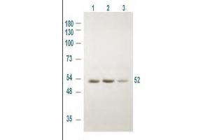 Western blot using Rockland's Affinity Purified anti-GSK3A antibody shows detection of a 52 kDa band corresponding to human GSK3A in various human derived 293T cell extracts. (GSK3 alpha Antikörper  (pSer21))