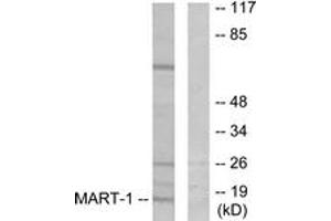 Western blot analysis of extracts from NIH-3T3 cells, using MART-1 Antibody. (MLANA Antikörper  (AA 41-90))