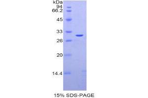 SDS-PAGE (SDS) image for Galectin 3 (LGALS3) (AA 1-262) protein (His tag) (ABIN1079623)