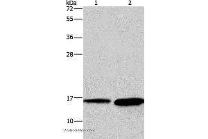 Western blot analysis of Mouse heart and human hepatocellular carcinoma tissue, using HINT2 Polyclonal Antibody at dilution of 1:300 (HINT2 Antikörper)