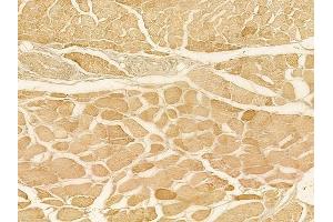 ABIN6257336 and ABIN6275089 at 1/100 staining human tongue carcinoma by IHC-P. (MYLIP Antikörper  (Internal Region))