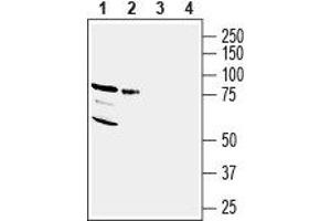 Western blot analysis of human MCF-7 breast adenocarcinoma cell lysate (lanes 1 and 3) and human MDA-MB-231 breast adenocarcinoma cell lysate (lanes 2 and 4): - 1,2. (Neuregulin 3 Antikörper  (Extracellular, N-Term))